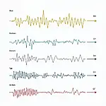 IELTS Listening Audio Speed Variations